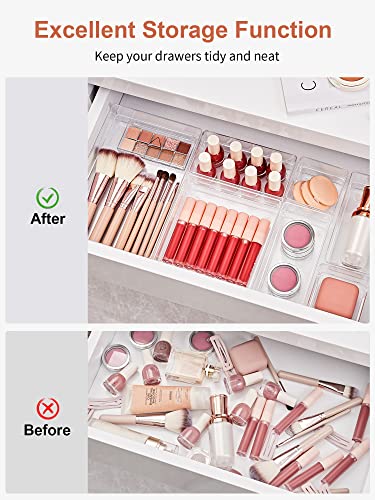 SMARTAKE 13 PCS Drawer Organizer 5-Size Desk Makeup Drawer Organizer Clear | Storage Trays for Makeup with Non Slip Silicone Pads, Jewelries, Utensils in Bedroom Dresser, Office, Kitchen and Bathroom - style: 13 PCS